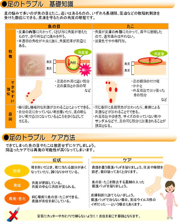 魚の目・タコなどの足のトラブル