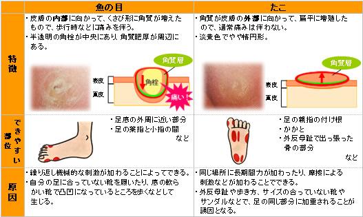 おすすめ情報|【11月】魚の目!たこ!足の悩みを改善しよう